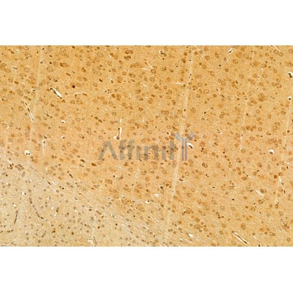 DACH1 Antibody - DF12008 at 1/100 staining Rat brain tissue by IHC-P.