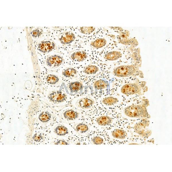 GADD34 Antibody - DF12009 at 1/100 staining Human normal tissues adjacent to colorectal cancer by IHC-P.