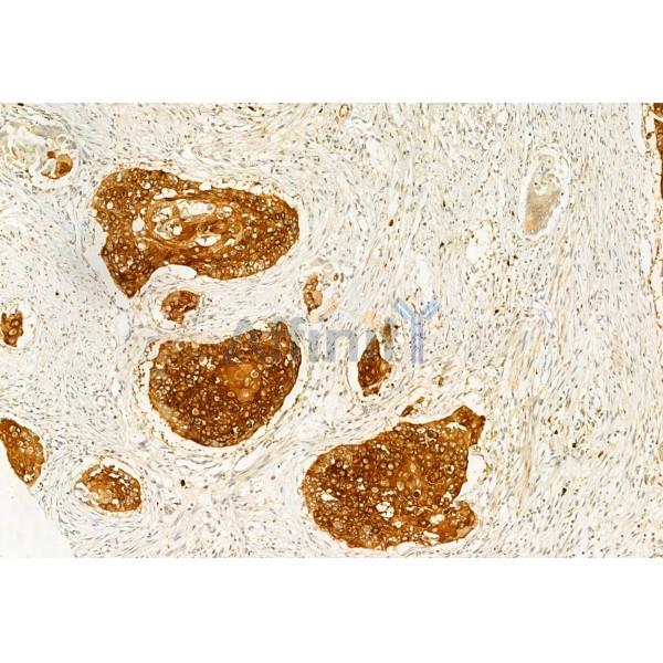 IFT20 Antibody - DF12014 at 1/100 staining Human normal tissues adjacent to esophageal cancer by IHC-P.