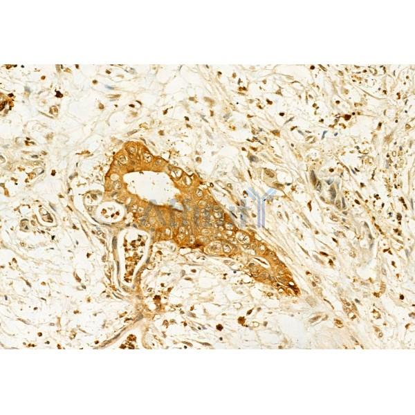 IFT20 Antibody - DF12014 at 1/100 staining Human normal tissues adjacent to pancreatic cancer by IHC-P.