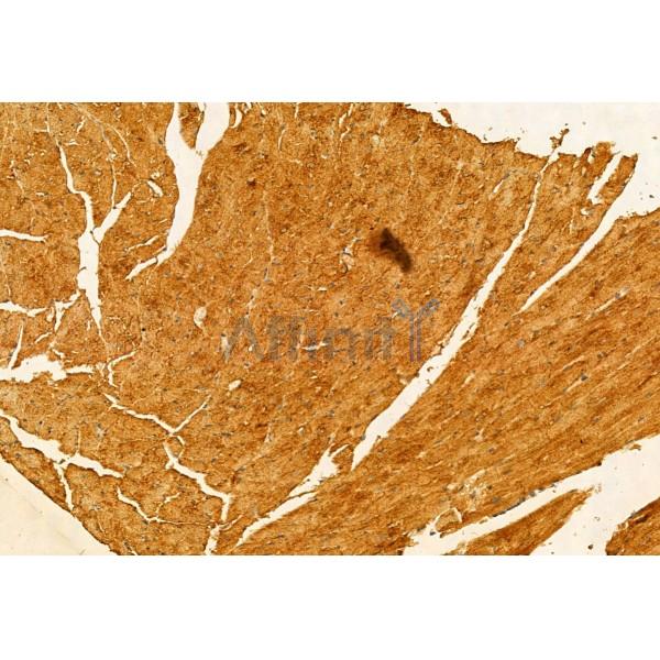 SMCR7L/MID51 Antibody - DF12019 at 1/100 staining Mouse heart tissue by IHC-P.