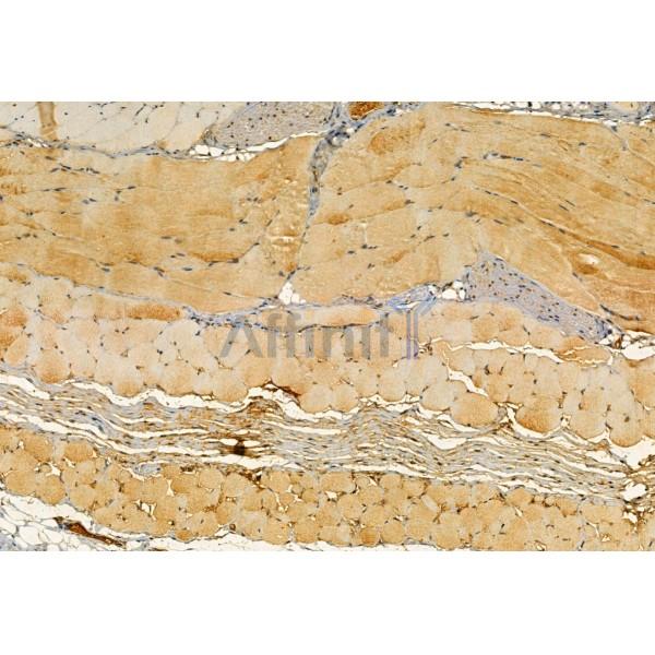 YME1L1 Antibody - DF12024 at 1/100 staining Mouse skin tissue by IHC-P.