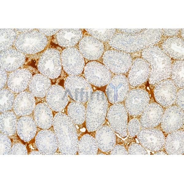 TCTN1 Antibody - DF12029 at 1/100 staining Mouse testis tissue by IHC-P.