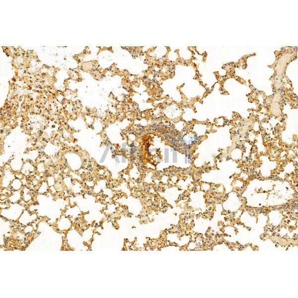 IFT81 Antibody - DF12032 at 1/100 staining Mouse lung tissue by IHC-P.