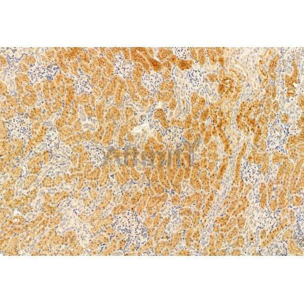 IFT81 Antibody - DF12032 at 1/100 staining Rat lung tissue by IHC-P.