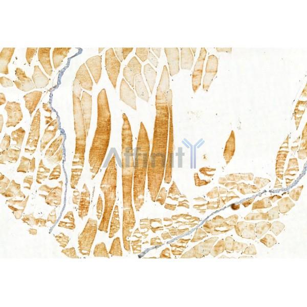 IFT81 Antibody - DF12032 at 1/100 staining Mouse muscle tissue by IHC-P.