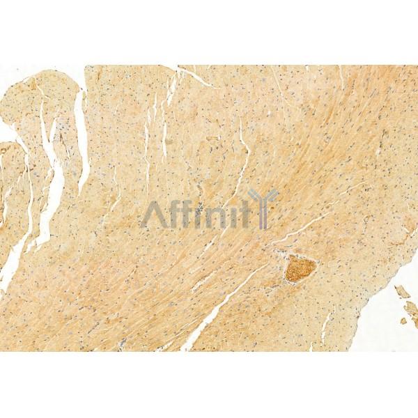 IFT81 Antibody - DF12032 at 1/100 staining Mouse heart tissue by IHC-P.