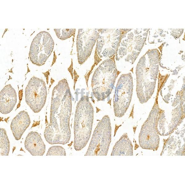 IFT81 Antibody - DF12032 at 1/100 staining Mouse testis tissue by IHC-P.