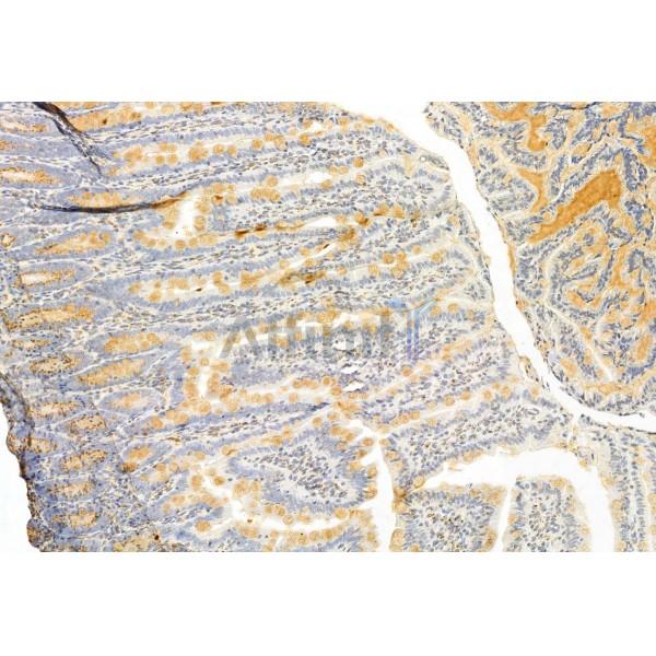 IFT81 Antibody - DF12032 at 1/100 staining Rat colon tissue by IHC-P.