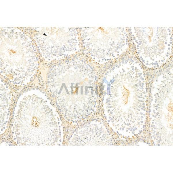IFT81 Antibody - DF12032 at 1/100 staining Rat testis tissue by IHC-P.