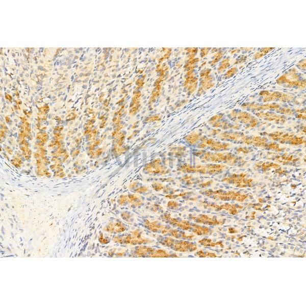 IFT81 Antibody - DF12032 at 1/100 staining Rat stomach tissue by IHC-P.