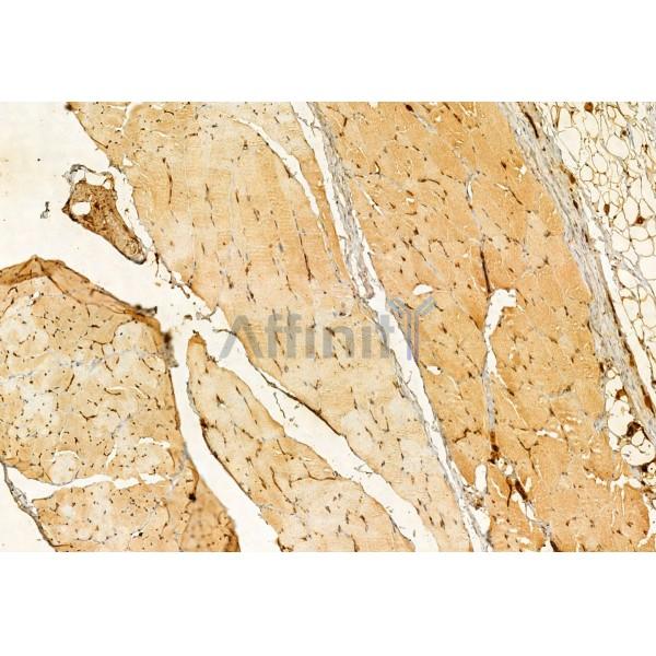 PRKCDBP Antibody - DF12035 at 1/100 staining Rat skin tissue by IHC-P.