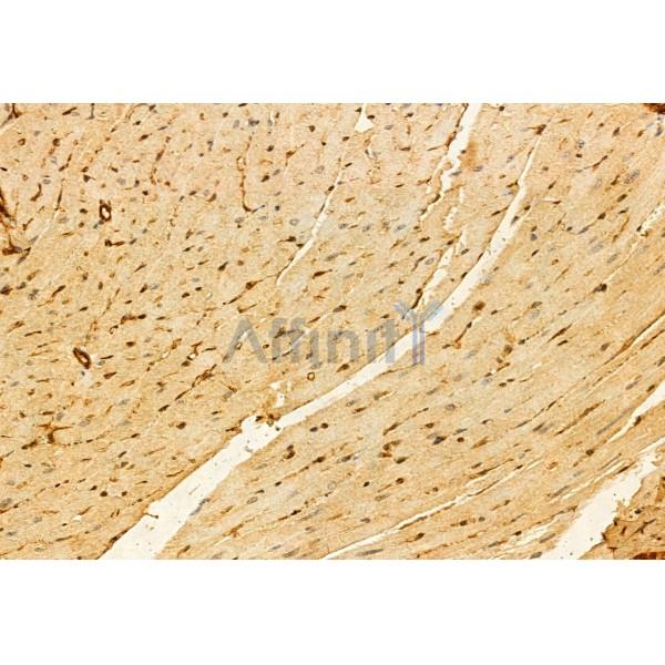 PRKCDBP Antibody - DF12035 at 1/100 staining Mouse heart tissue by IHC-P.