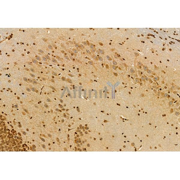 S100A14 Antibody - DF12042 at 1/100 staining Rat brain tissue by IHC-P.