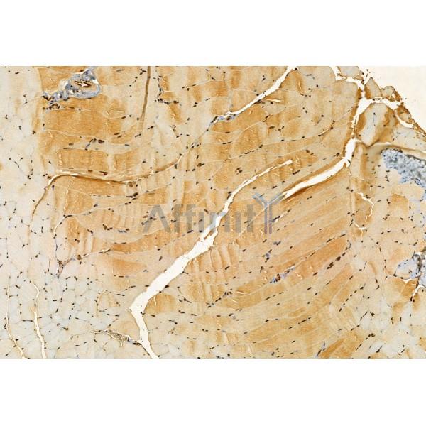 SEC5/EXOC2 Antibody - DF12043 at 1/100 staining Mouse muscle tissue by IHC-P.
