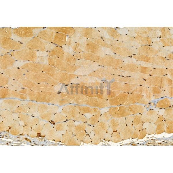 SEC5/EXOC2 Antibody - DF12043 at 1/100 staining Mouse skin tissue by IHC-P.