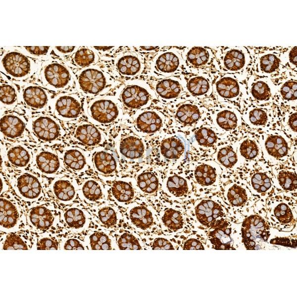 SEC5/EXOC2 Antibody - DF12043 at 1/100 staining Human normal tissues adjacent to colorectal cancer by IHC-P.