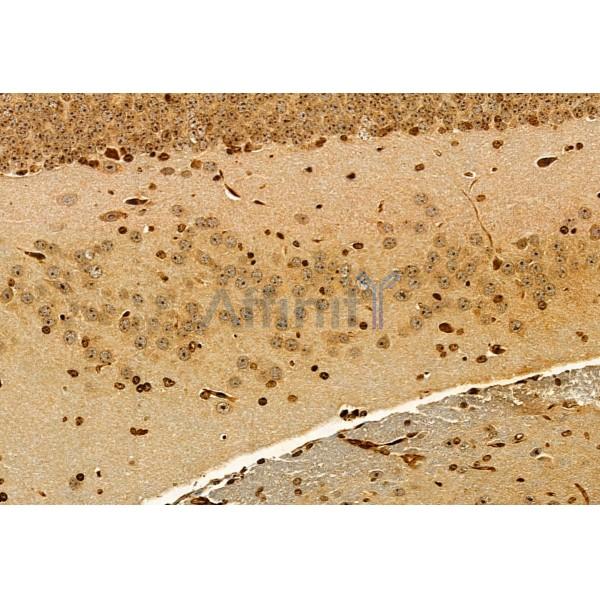 SEC5/EXOC2 Antibody - DF12043 at 1/100 staining Mouse brain tissue by IHC-P.