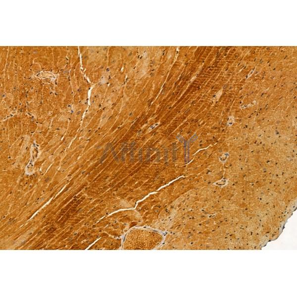 TOM70 Antibody - DF12045 at 1/100 staining Mouse heart tissue by IHC-P.