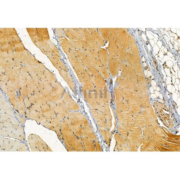 TOM70 Antibody - DF12045 at 1/100 staining Rat skin tissue by IHC-P.