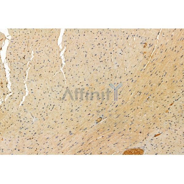 IFT57 Antibody - DF12047 at 1/100 staining Mouse heart tissue by IHC-P.