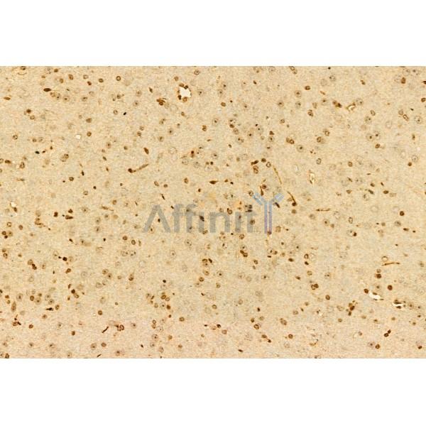 AIMP2/p38 Antibody - DF12048 at 1/100 staining Mouse brain tissue by IHC-P.
