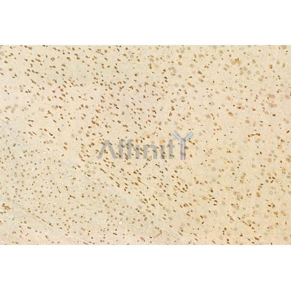 AIMP2/p38 Antibody - DF12048 at 1/100 staining Rat brain tissue by IHC-P.