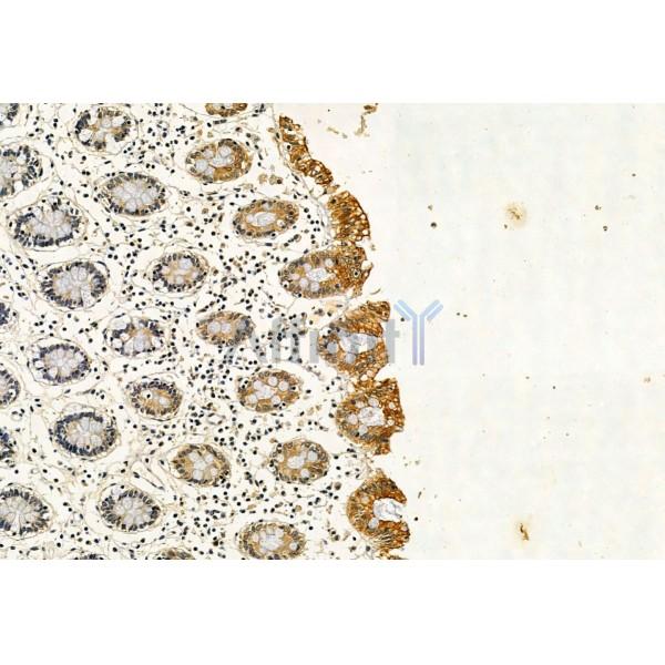 NBR1 Antibody - DF12049 at 1/100 staining Human normal tissues adjacent to colorectal cancer by IHC-P.