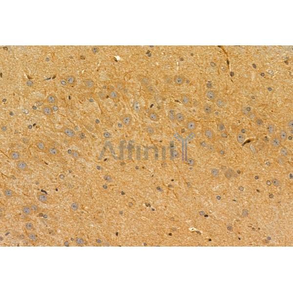 PYCR1 Antibody - DF12051 at 1/100 staining Rat brain tissue by IHC-P.