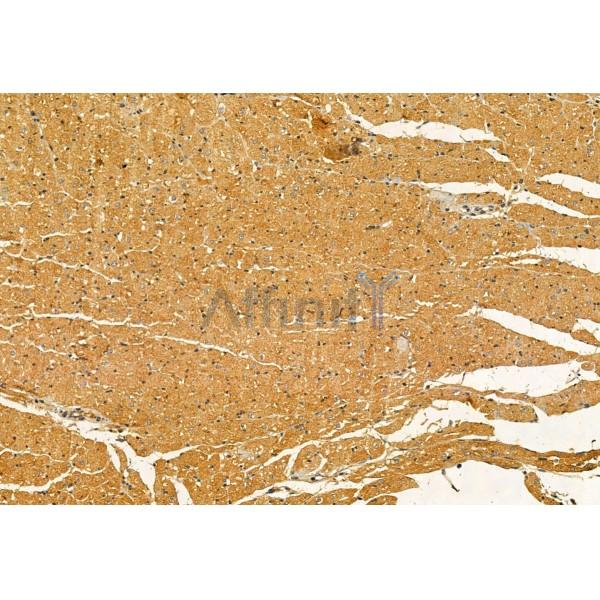 PYCR1 Antibody - DF12051 at 1/100 staining Rat heart tissue by IHC-P.