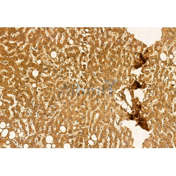 PYCR1 Antibody - DF12051 at 1/100 staining Human normal tissues adjacent to liver cancer by IHC-P.