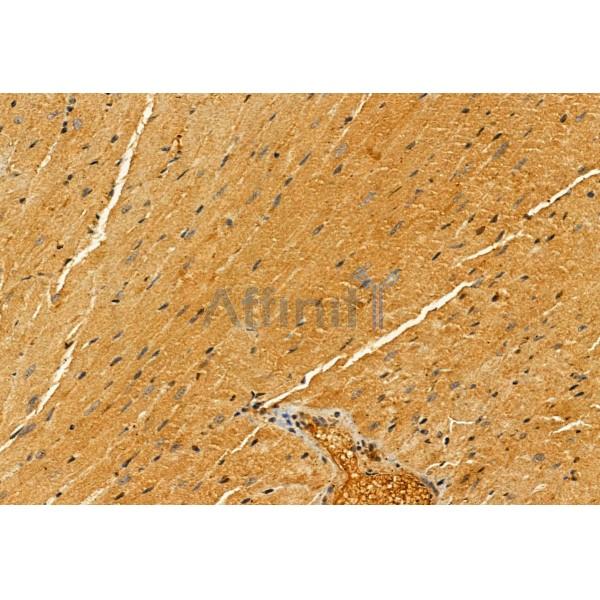 PYCR1 Antibody - DF12051 at 1/100 staining Mouse heart tissue by IHC-P.