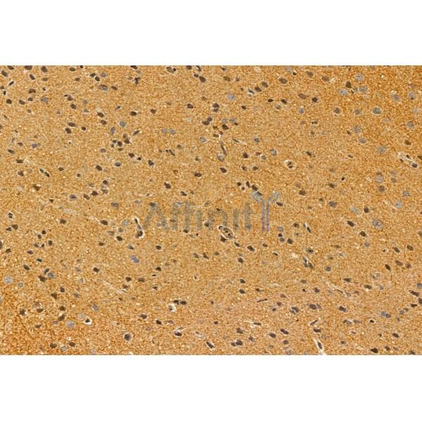 CRBN Antibody - DF12054 at 1/100 staining Rat brain tissue by IHC-P.