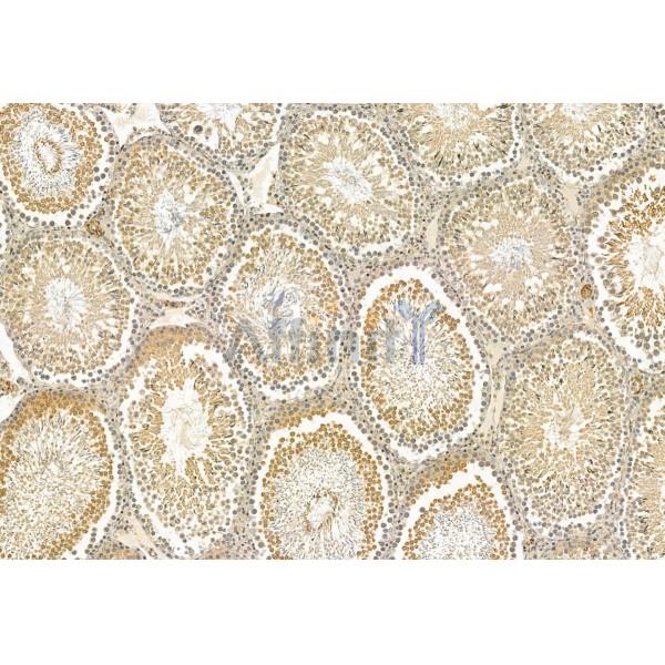 CRBN Antibody - DF12054 at 1/100 staining Rat testis tissue by IHC-P.
