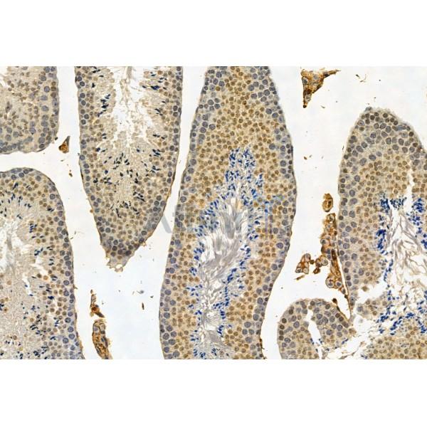 CRBN Antibody - DF12054 at 1/100 staining Mouse testis tissue by IHC-P.