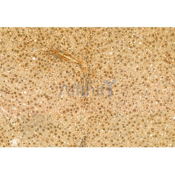 RBM15 Antibody - DF12061 at 1/100 staining Rat liver tissue by IHC-P.