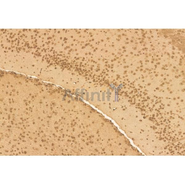 RBM15 Antibody - DF12061 at 1/100 staining Mouse brain tissue by IHC-P.