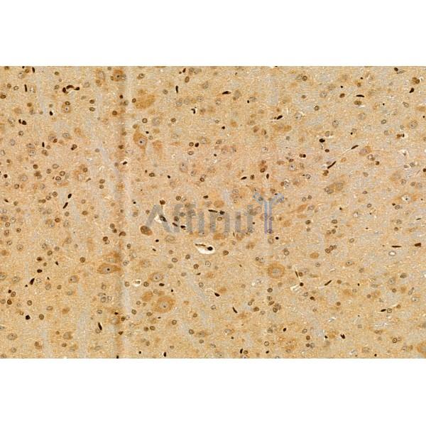 UBAP1 Antibody - DF12064 at 1/100 staining Rat brain tissue by IHC-P.