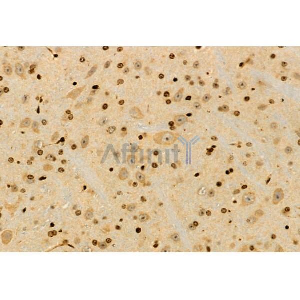 UBAP1 Antibody - DF12064 at 1/100 staining Mouse brain tissue by IHC-P.