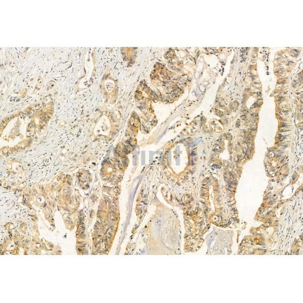 COMMD1 Antibody - DF12068 at 1/100 staining Human normal tissues adjacent to colorectal cancer by IHC-P.