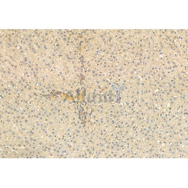 COMMD1 Antibody - DF12068 at 1/100 staining Rat liver tissue by IHC-P.