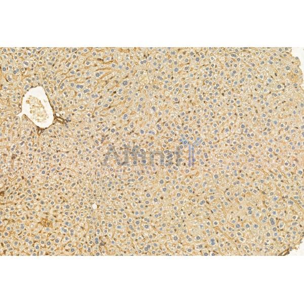 COMMD1 Antibody - DF12068 at 1/100 staining Mouse liver tissue by IHC-P.