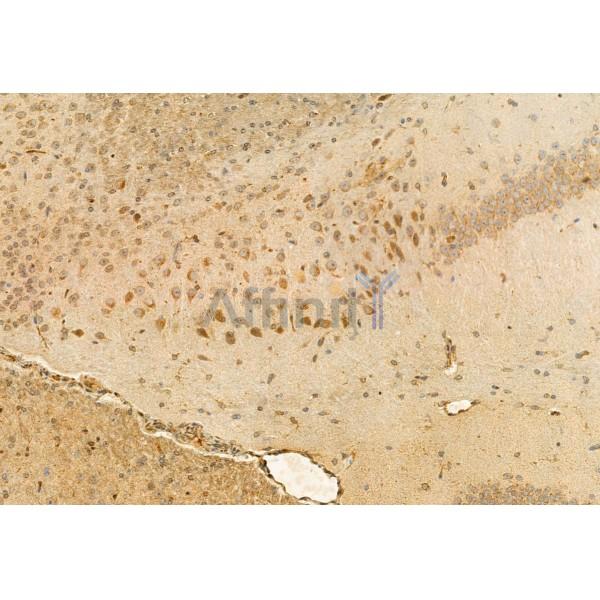 COMMD1 Antibody - DF12068 at 1/100 staining Mouse brain tissue by IHC-P.