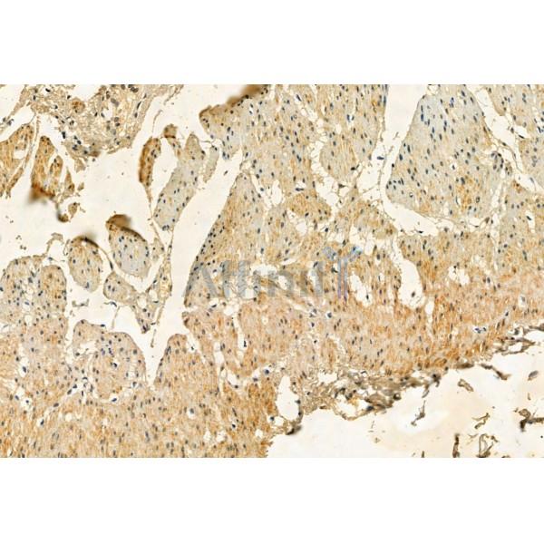 FKBP65 Antibody - DF12073 at 1/100 staining Human normal tissues adjacent to gastric cancer by IHC-P.
