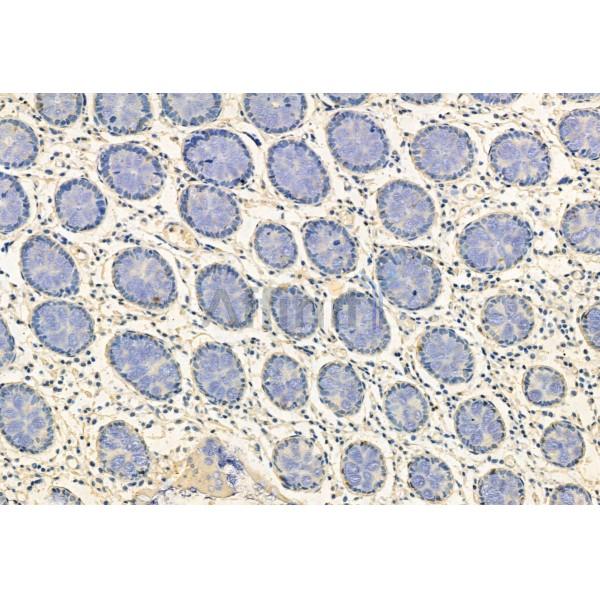 FKBP65 Antibody - DF12073 at 1/100 staining Human normal tissues adjacent to colorectal cancer by IHC-P.