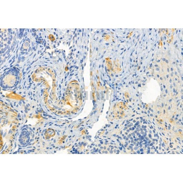 FKBP65 Antibody - DF12073 at 1/100 staining Rat ovary tissue by IHC-P.