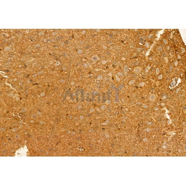 HEPACAM Antibody - DF12075 at 1/100 staining Rat brain tissue by IHC-P.