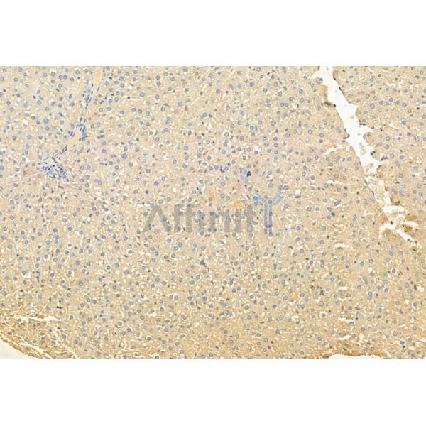 HEPACAM Antibody - DF12075 at 1/100 staining Rat liver tissue by IHC-P.