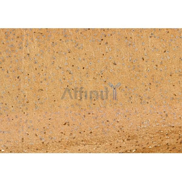 HEPACAM Antibody - DF12075 at 1/100 staining Mouse brain tissue by IHC-P.