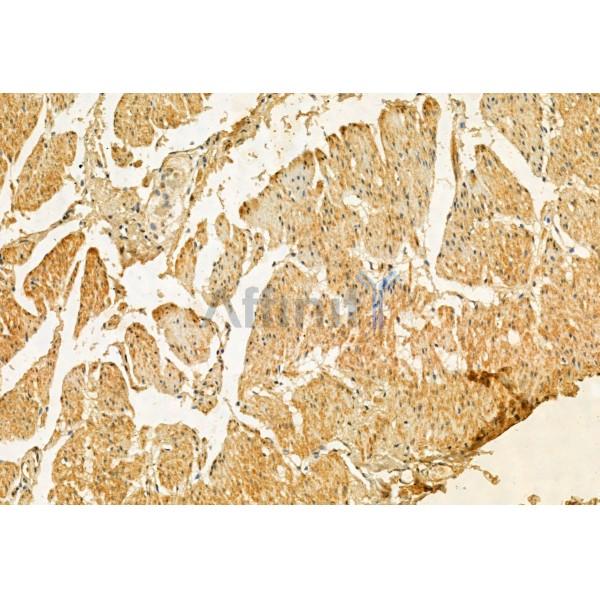 Kindlin 2 Antibody - DF12078 at 1/100 staining Human normal tissues adjacent to gastric cancer by IHC-P.
